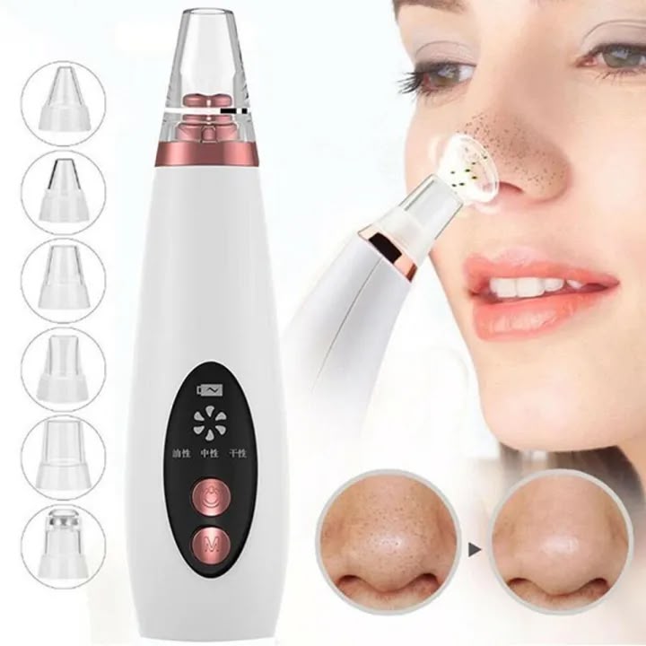 Blackhead Removal Vacuum Tool/Device