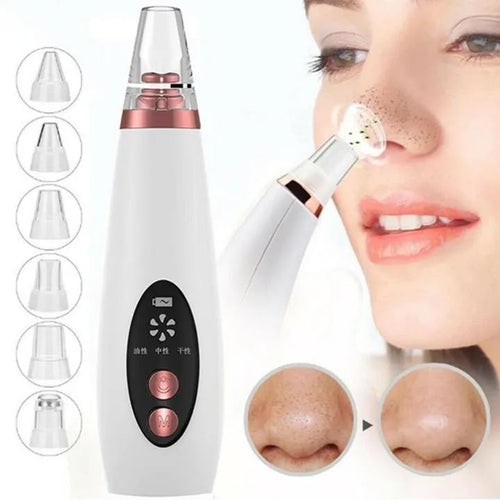 Blackhead Removal Vacuum Tool/Device